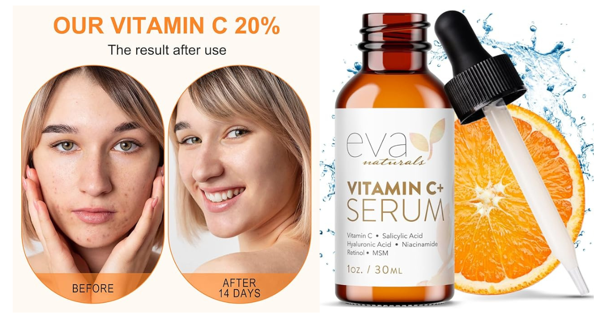 vitamin c serum benefits